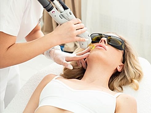 Виды эпиляции лазером - какой лазер лучше?